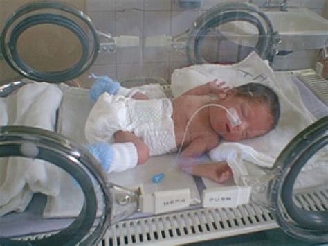 Alertan Del Peligro De La Ventilación Artificial En Bebés Prematuros