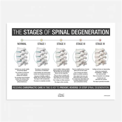 The Stages Of Spinal Degeneration Poster Kirografiks