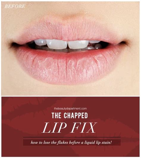 Chapped Lip Quick Fix Chapped Lips The Beauty Department Chronic