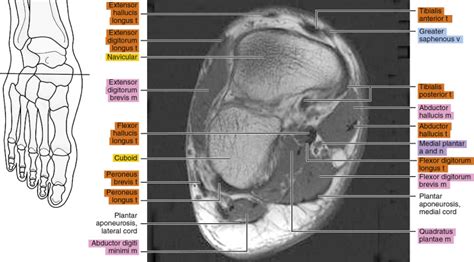 Foot Muscles Mri Anatomy Interosseous Muscles Of Foot Anatomy Plantar