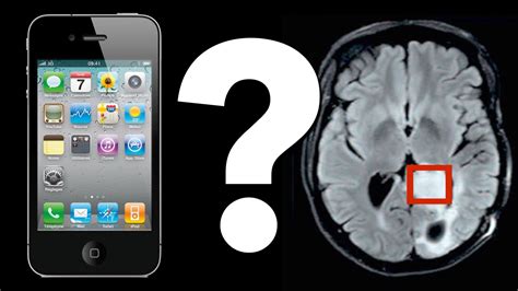 Cell Phone Use Driving Rise In Brain Tumors The Bridge News