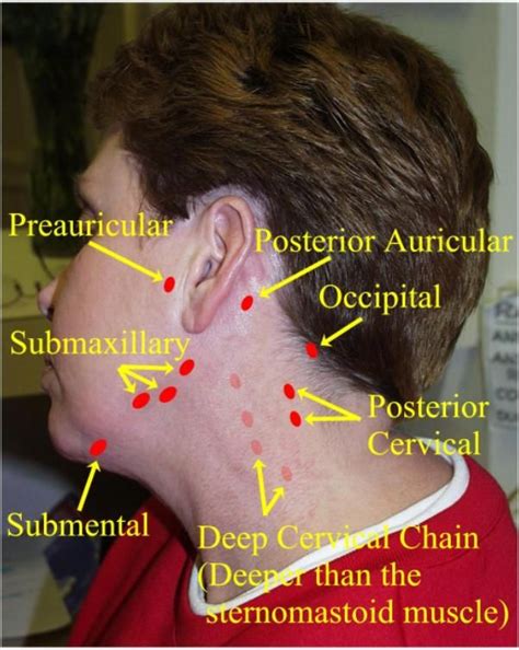 Cat Swollen Lymph Nodes Neck Morton Pruett