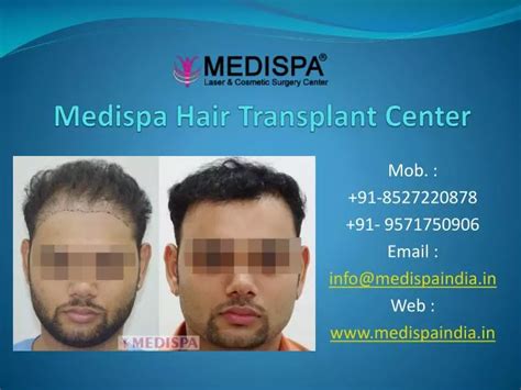 Ppt Best Hair Transplant Clinic In Dubai Powerpoint Presentation Free Download Id7763296