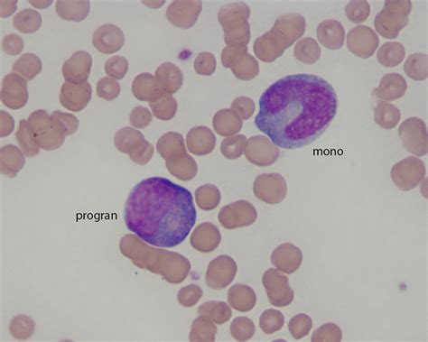 Monocyte Archives Eclinpath