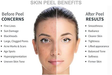 Chemical Peel What You Need To Know Vasantha Natarajan Md Aesthetic And Wellness Clinic