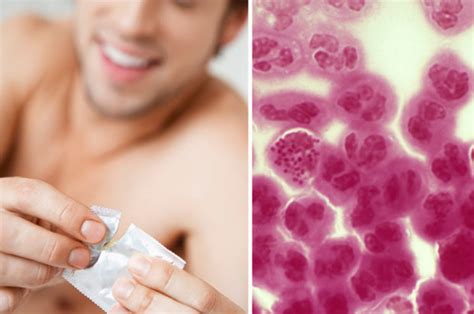 Sti Risk Huge Rise Gonorrhoea And Syphilis Cases Spark Sexual Health