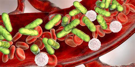 Bacterial Blood Infection Illustration Stock Image F0245783