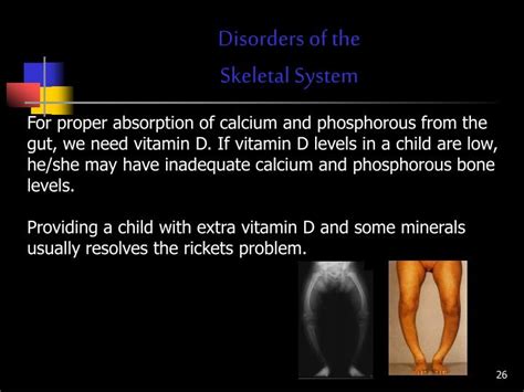 Ppt 103 Understand The Functions And Disorders Of The Skeletal