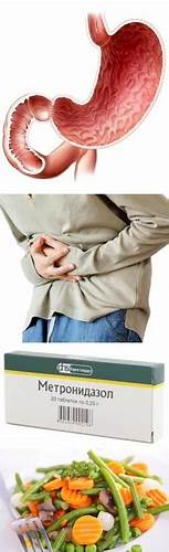 Гастродуоденит - обсуждение Картинка - Гастродуоденит - обсуждение