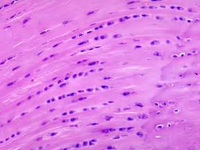 Fibrocartilage Connective Tissue Fibrocartilage Cell Biology