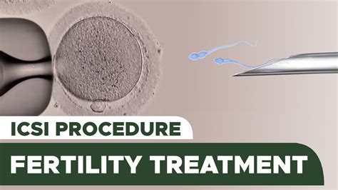 A Step By Step Look At The Ivf Process Intracytoplasmic Sperm