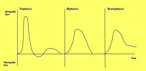 What Is The Difference Between Biphasic And Triphasic Waveforms
