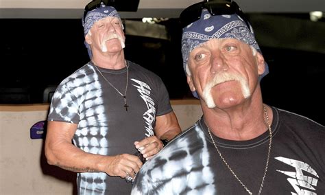Hulk Hogan Severely Burns His Hand In Accident And Then Proudly