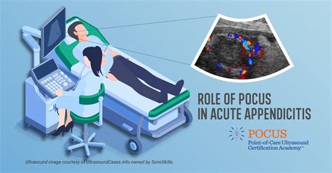 Role Of Pocus In Acute Appendicitis Point Of Care Ultrasound