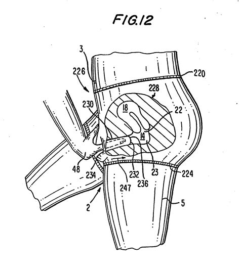 Patent EP B Female Barrier Contraceptive With Vacuum Anchoring
