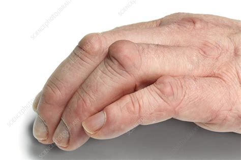 Knuckle Pads Stock Image C0225504 Science Photo Library