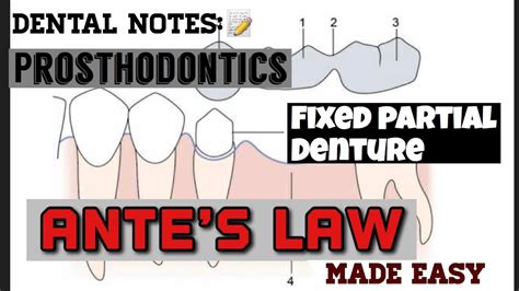Study With Me Dentistry Lectures Prosthodontics Fixed Partial