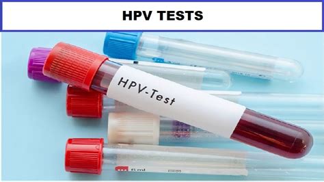 Hpv Tests A Guide To Screening And Prevention Helal Medical