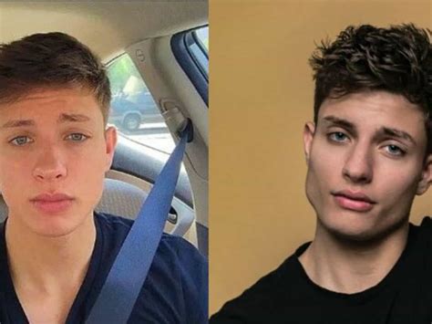 Matt Rife Before Surgery