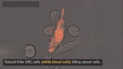 Natural Killer Cellwhite Blood Cells Killing Cancer Cells Youtube