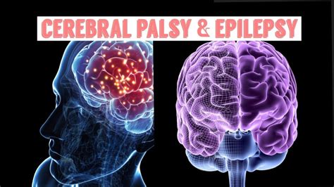 Are Cerebral Palsy And Epilepsy Connected Brain Disorders And Other