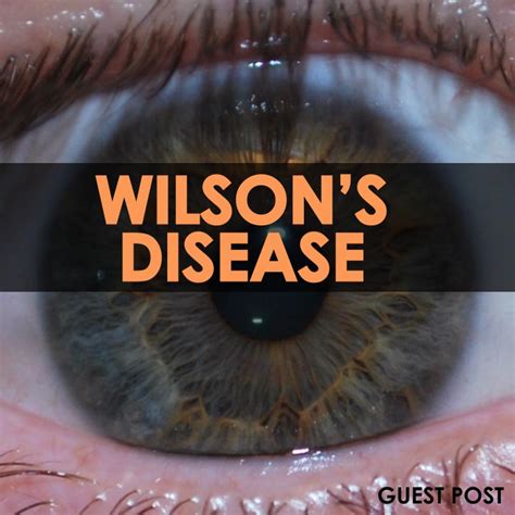 Symptoms Of Wilsons Disease Wilsons Healthresource4u Diseases