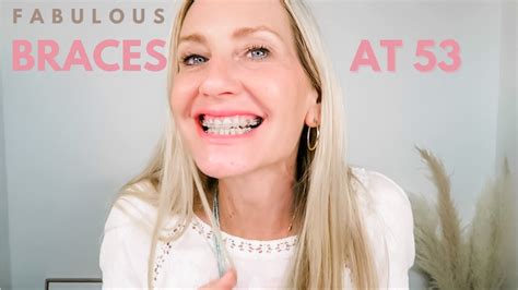 Getting Braces Over 50 Am I Too Old For Braces Youtube