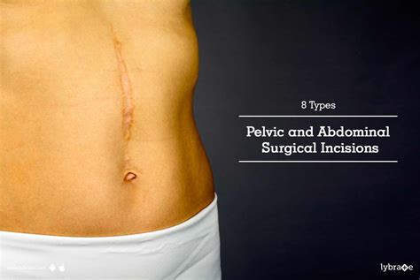 8 Types Pelvic And Abdominal Surgical Incisions By Dr Jagat Pal