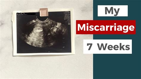 Miscarriage At 8 Weeks What To Expect