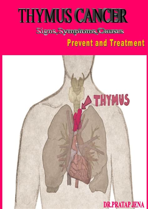 Thymus Gland Disorders