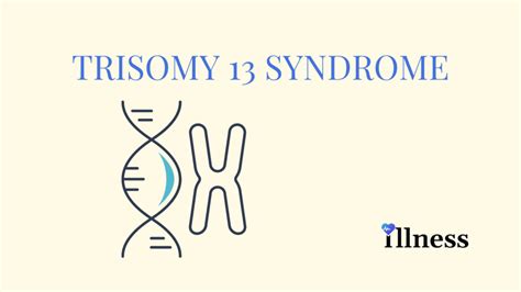 Trisomy 13 Syndrome Overview Causes Symptoms Treatment