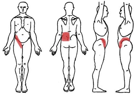 Ingham claimed that the feet and hands were especially sensitive. diagram showing kidney pain can be felt in the lower back and groin area | Health | Pinterest