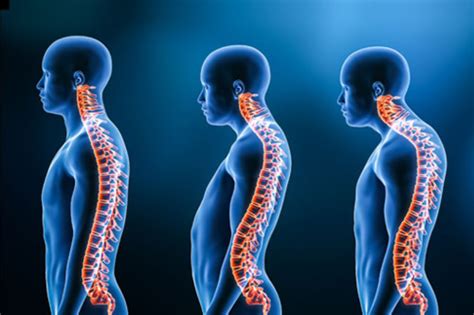 Spinal Deformities Expert Care By Dr Mandar Borde At Dr Borde Clinic