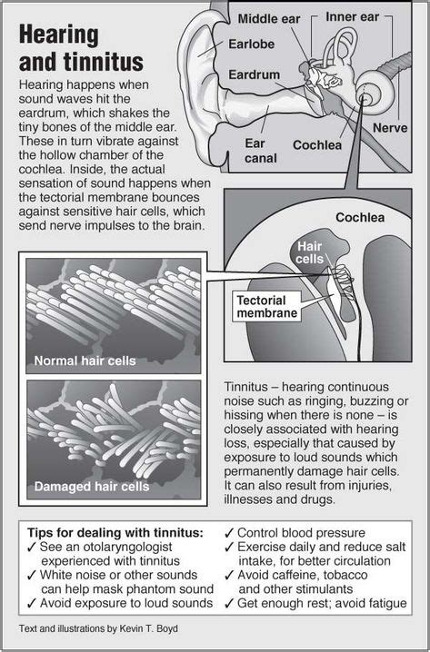 Information Graphic About Tinnitus With Links To Acupressure For
