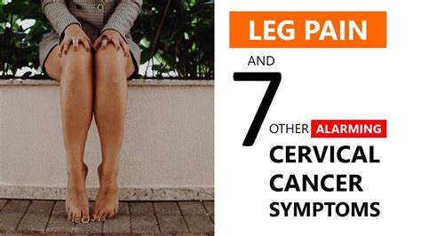 Cervical Cancer Leg Pain Symptoms Alarming Signs YouTube