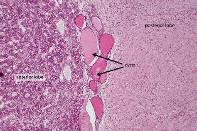Endocrine System week #1 Flashcards | Easy Notecards