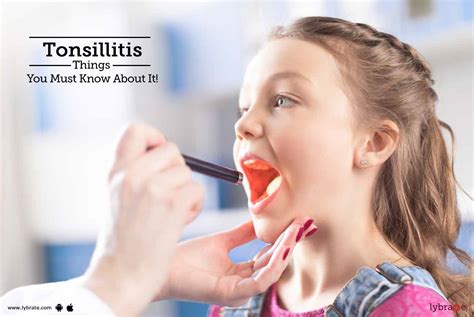 Tonsillitis Things You Must Know About It By Dr Sadat Qureshi