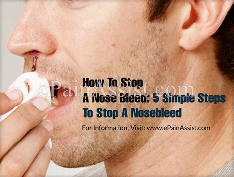 How To Stop A Nose Bleed 5 Simple Steps To Stop A Nosebleed