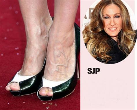 Celebrities With Ugly Feet Pics