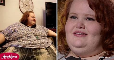 Obese Woman Sheds Lbs And Looks Like A Totally Different Person Now