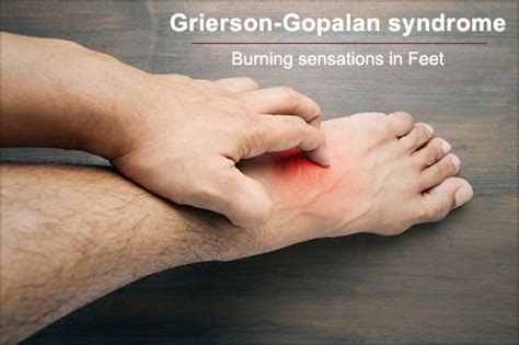 Ayurvedic View On Grierson Gopalan Syndrome And Its Treatment