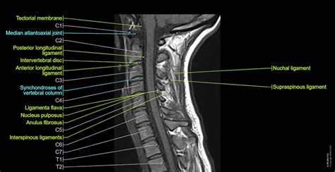 Cervical Spine Mri Normal Anatomy E Anatomy