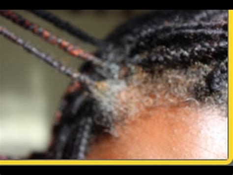 And since hair growth is a relatively low priority compared to other bodily functions, hair growth is halted quickly when your body is placed under stress due to restrictive dieting, she explained. Braids/New Growth - YouTube