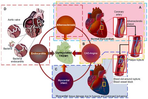 Jcdd Free Full Text Trem 1 Is It A Pivotal Target For Cardiovascular Diseases