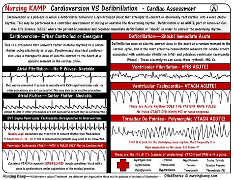 Telemetry Defibrillation Vs Cardioversion Nurse Nursing Notes Cardiac Assessment