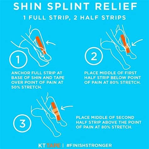 Shin Splints Shin Splints Shin Splints Treatment Kinesiology Taping