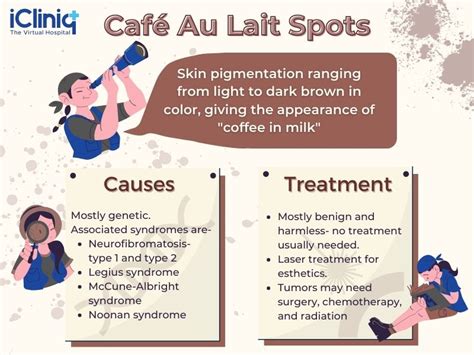 Café Au Lait Spots Causes Diagnosis Treatment