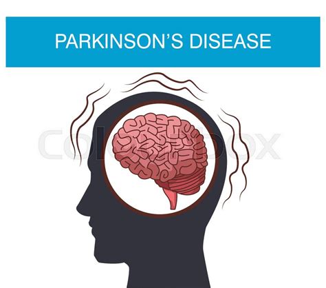 Parkinsons Disease Cartoon Icon Vector Stock Vector Colourbox