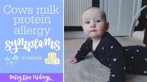 Our scary experience reintroducing dairy after having a. Cows Milk Protein Allergy (CMPA) symptoms in a baby | Dairy Free Fridays - YouTube