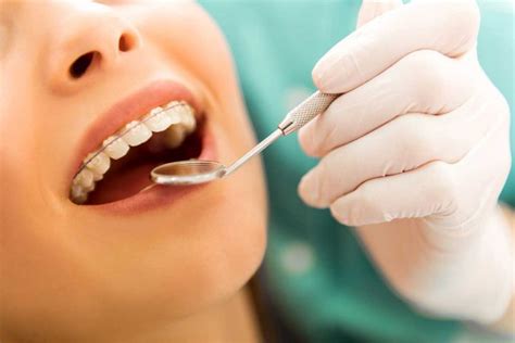 How Much Do Braces Cost Westwood Dental Houston